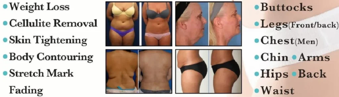 Chiropractor Fair Lawn NJ