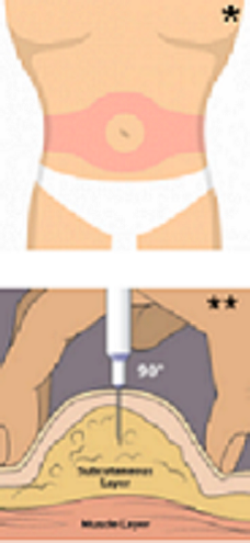 Melatonin Injections For Tanning